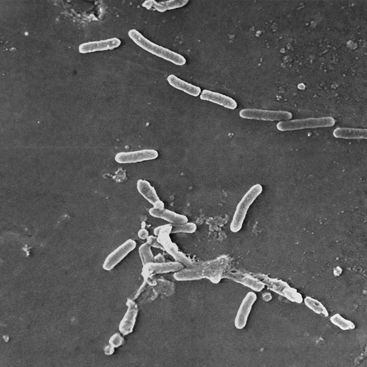 Eye drops recalled after US drug-resistant bacteria outbreak